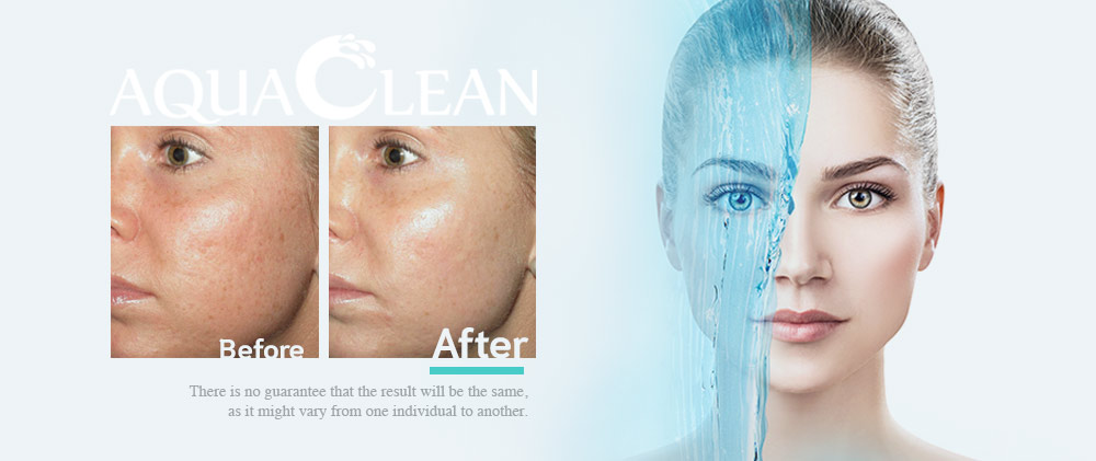 AquaClean_BA